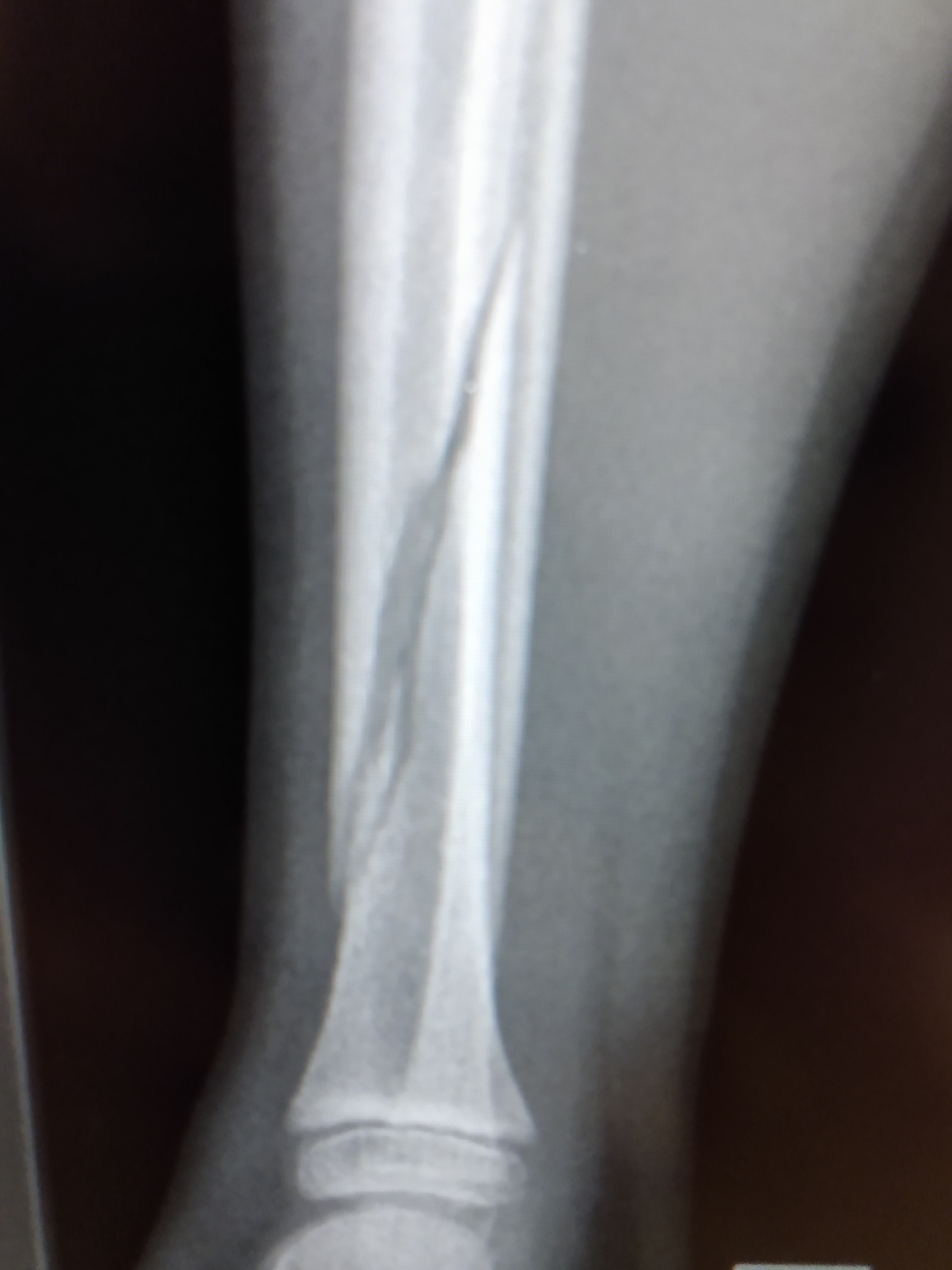 IMG_20200125_180637895